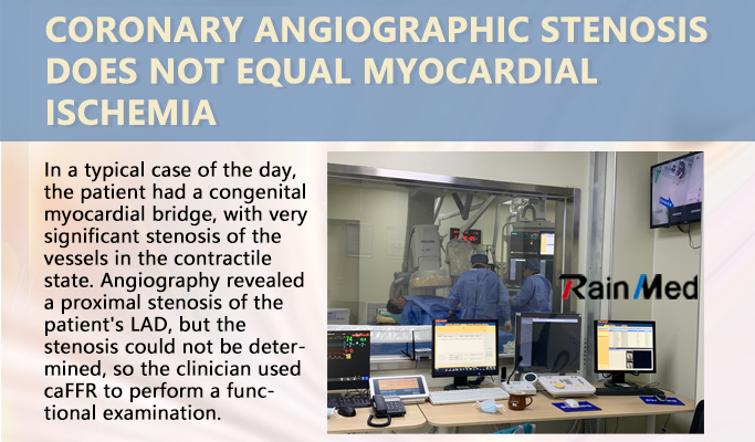 Coronary angiographic stenosis does not equal myocardial ischemia